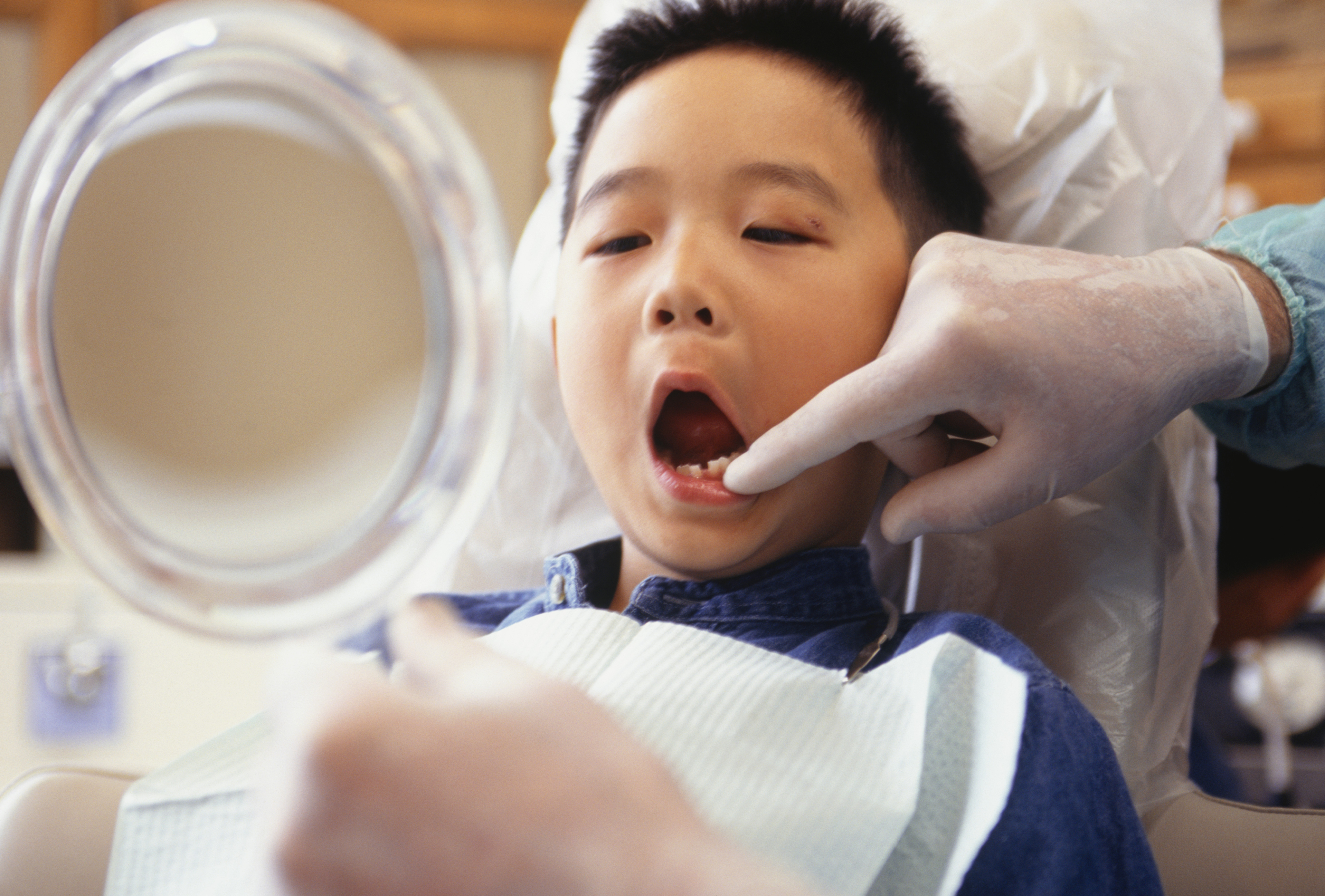 Niño durante un examen de sus dientes por un dentista.