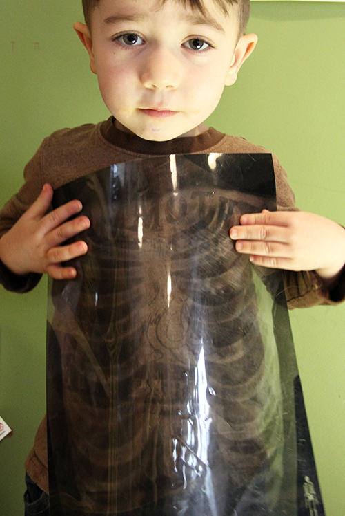 Aboy holding chest xray