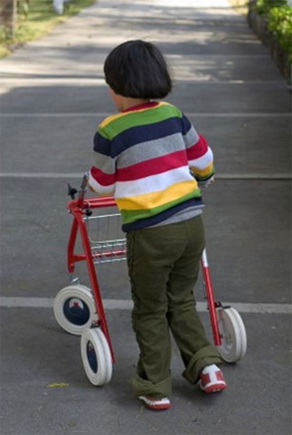 Niño con discapacidad para caminar